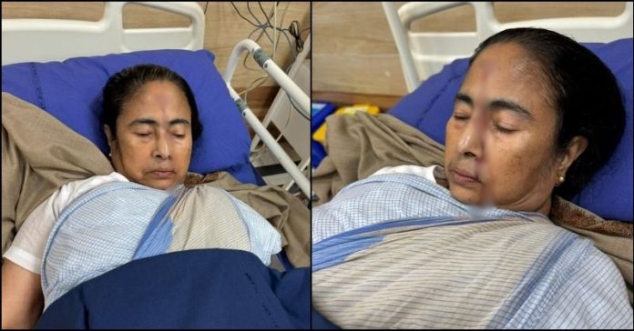 મમતા બેનર્જી ઈજાગ્રસ્ત